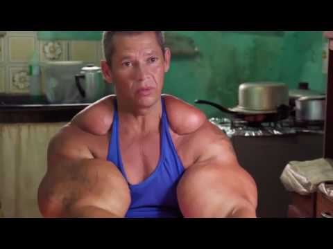 Too much synthol, destroyers of muscles